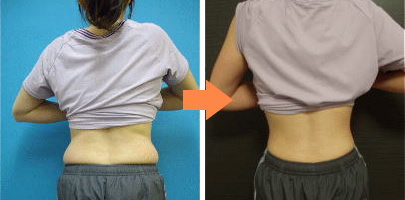 大阪市西区（心斎橋）加圧トレーニングセンター施設