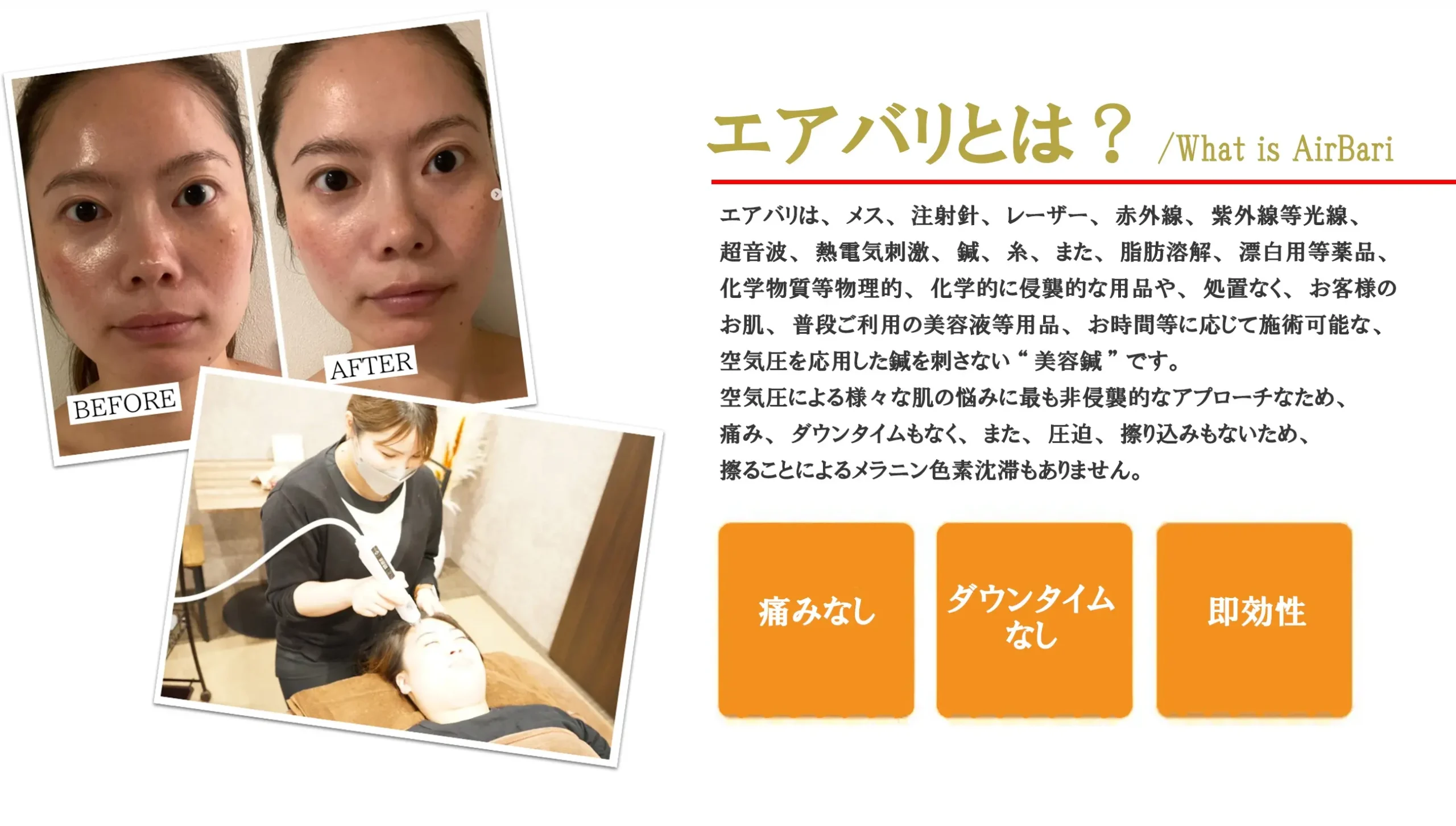 話題の空気鍼（エアバリ）-HatchingBeauty代理店-