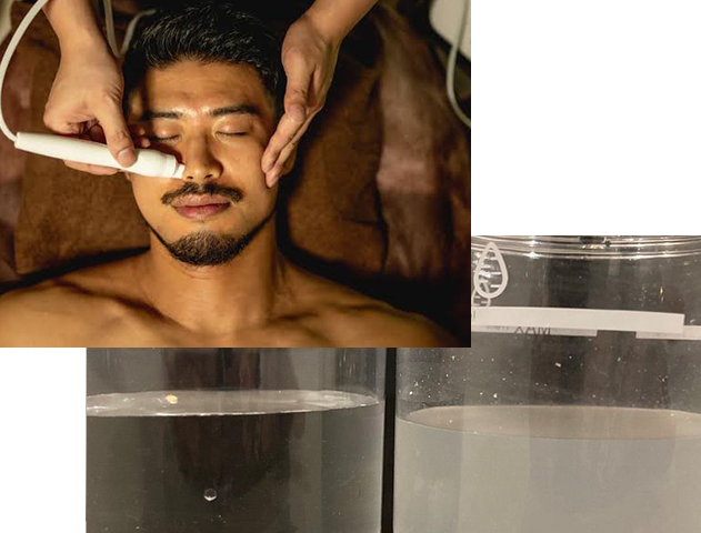 仙台の男性メンズ・ヒゲ脱毛専門店【ZERO＆RESET(ゼロアンドリセット)】