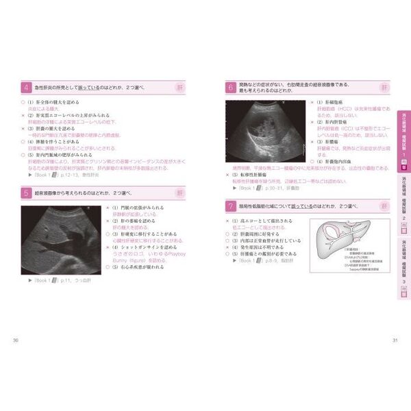 超音波検査士認定試験対策 過去問分析～出題のポイントで学ぶ！ 臨床編