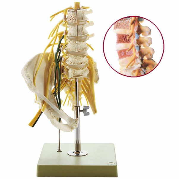 腰椎と神経支配模型 QS66/2 | タカチホメディカルショップ