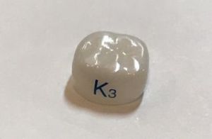 白いジルコニア乳歯冠 - 都筑キッズデンタルランド｜小児歯科専門