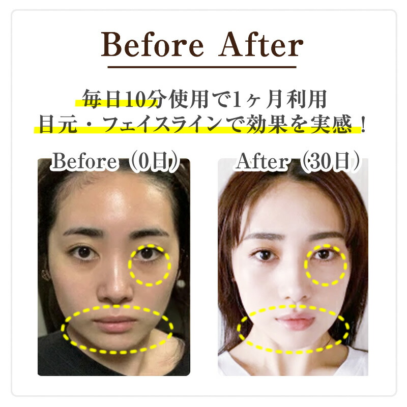 楽天市場】【ELFACE公式】公式 美顔器 リフトアップ ems 目元 エル