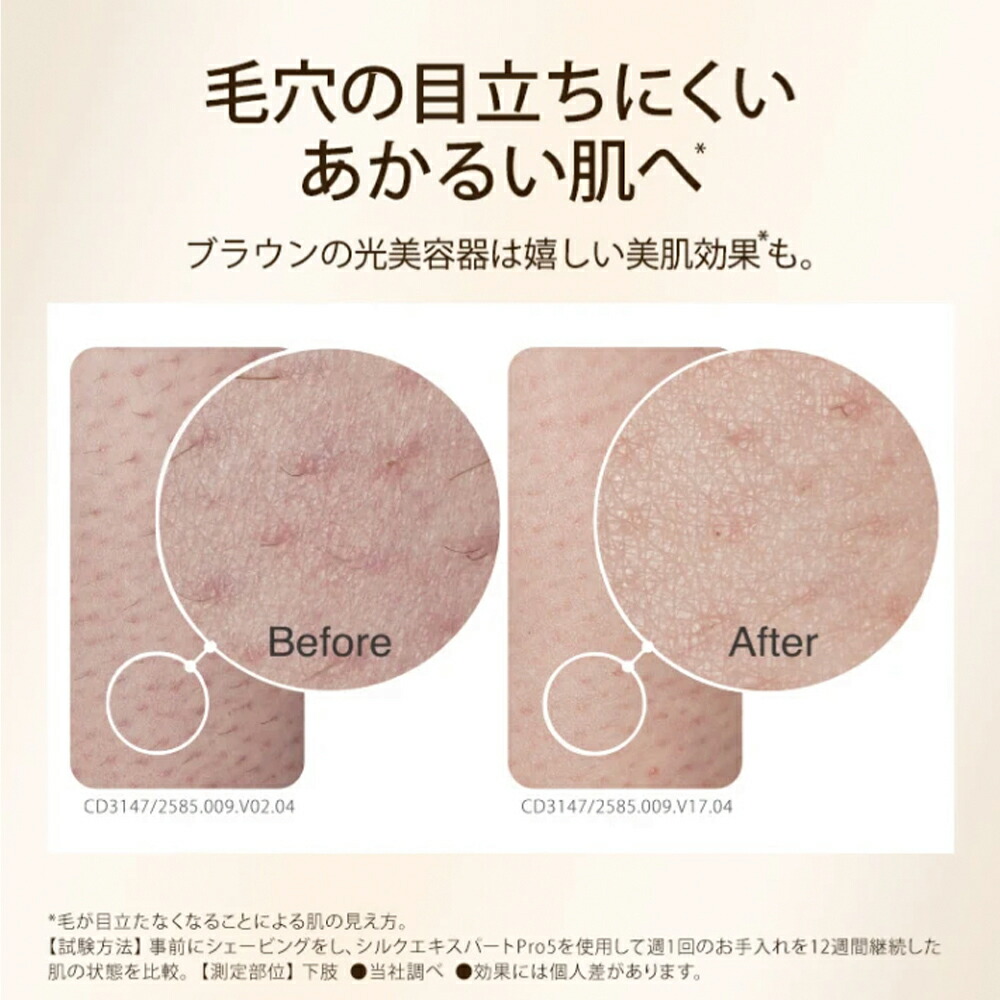 楽天市場】ブラウン 脱毛器 シルクエキスパート Pro5 光美容器 家庭用