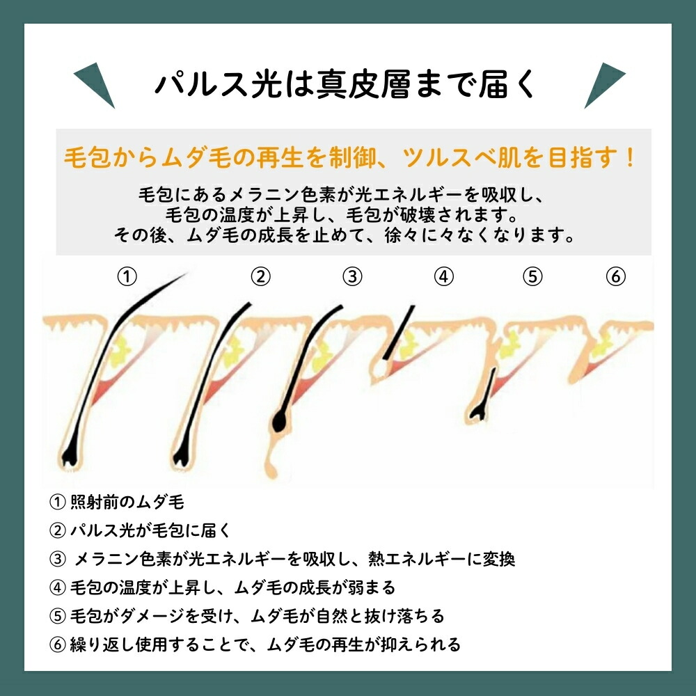 楽天市場】楽天ランキング1位獲得 脱毛器 AURORA オーロラ グリーン