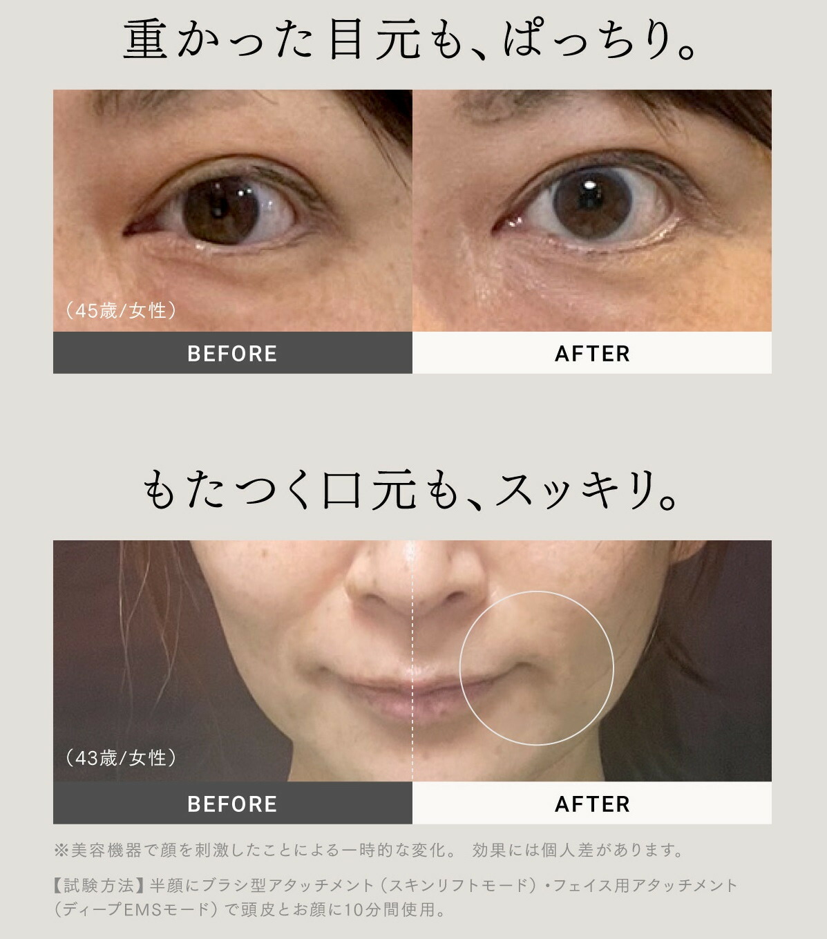 楽天市場】【ふるさと納税】EMS 美顔器 MYTREX PROVE | 1年保証 取扱