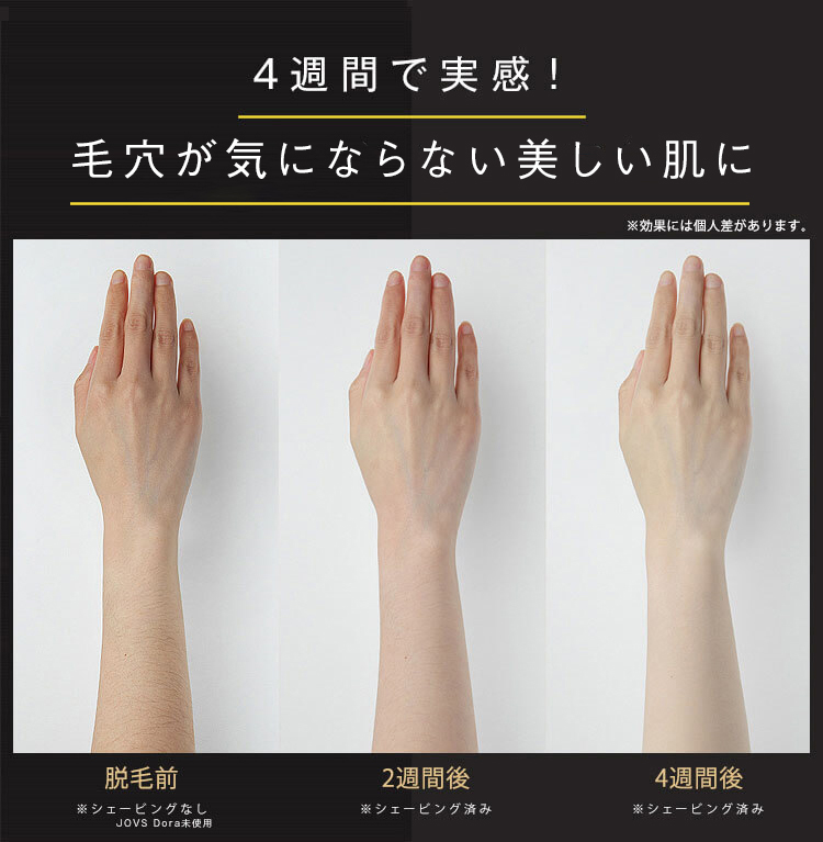 楽天市場】JOVS Dora1 J847モデル ピュアホワイト 脱毛器 ランキング1