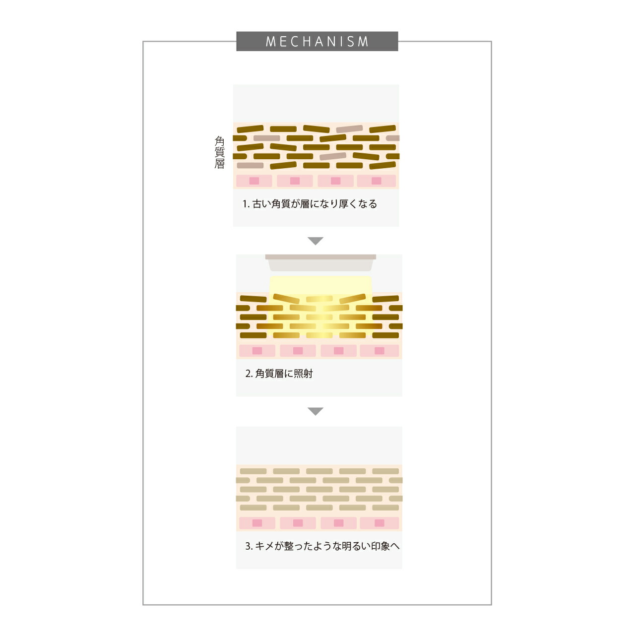 楽天市場】【 肌ケアしながら脱毛/日本語説明書付き (1年保障) 】 全身