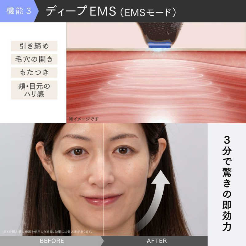 楽天市場】MYTREX マルチヘッド美顔器 MiRAY ONE(マイトレックス