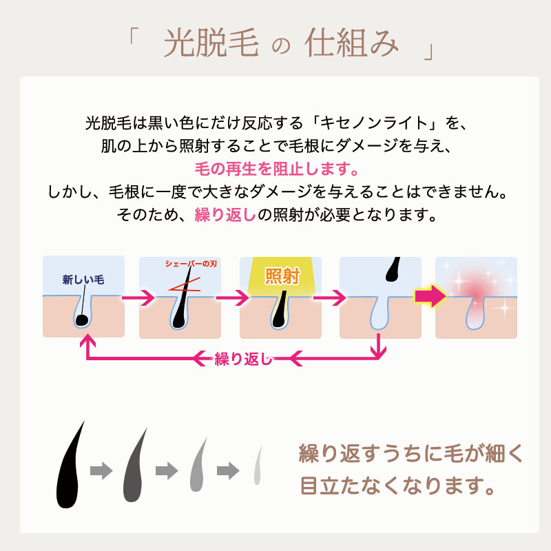 楽天市場】本日限定 50,000円OFFクーポン 【STYLISH JAPAN 公式】 脱毛