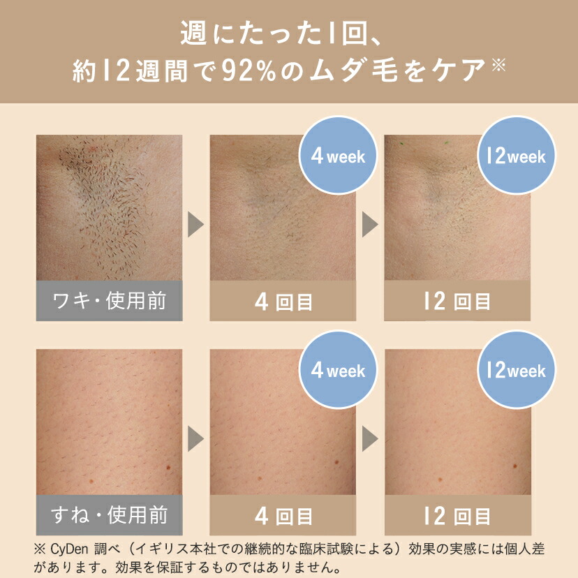 楽天市場】【クーポン利用で25,282円 2/27 8:59まで】脱毛器 痛みレス