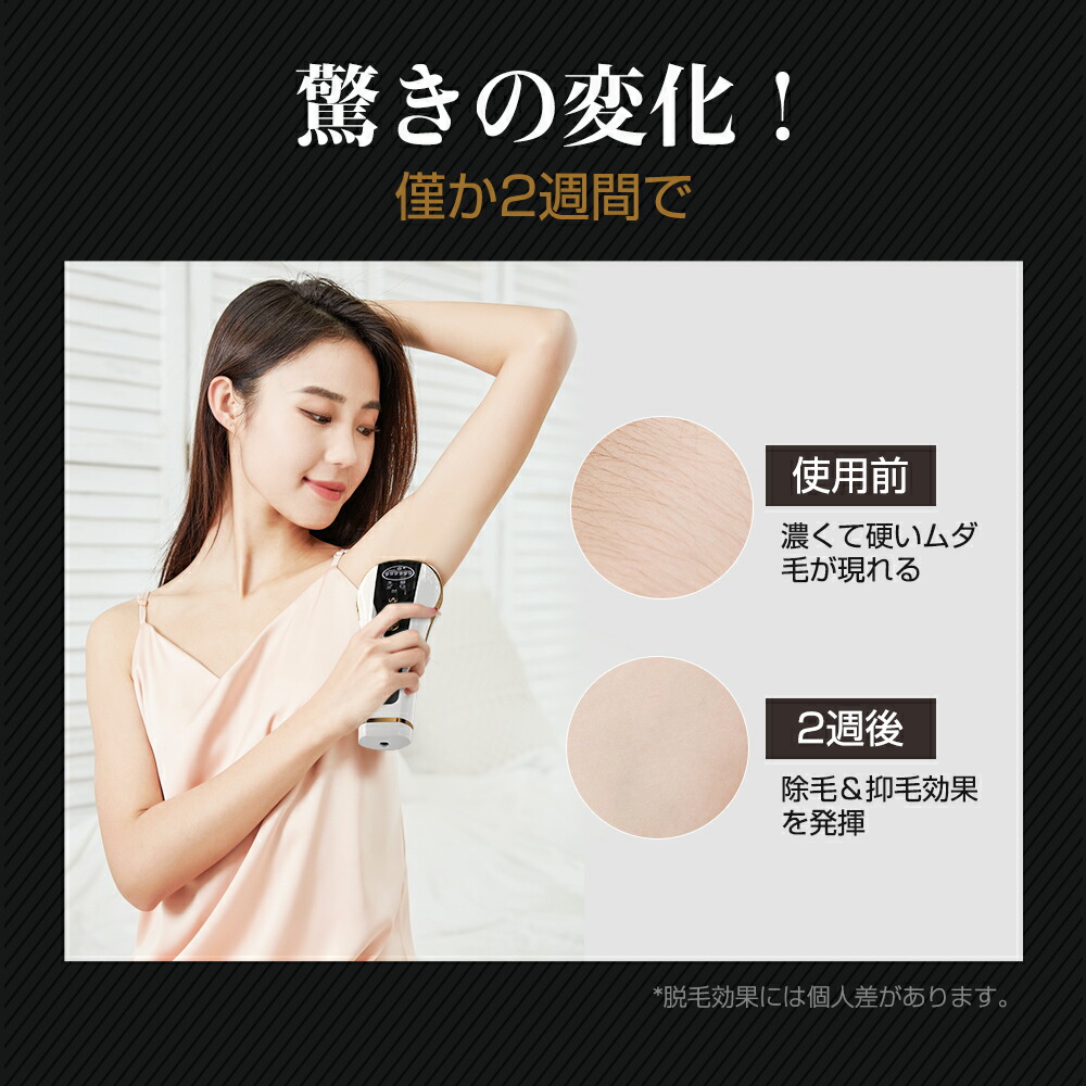 楽天市場】次世代HIPL脱毛 脱毛器 脱毛 フラッシュ式 ケア 肌 HIPL