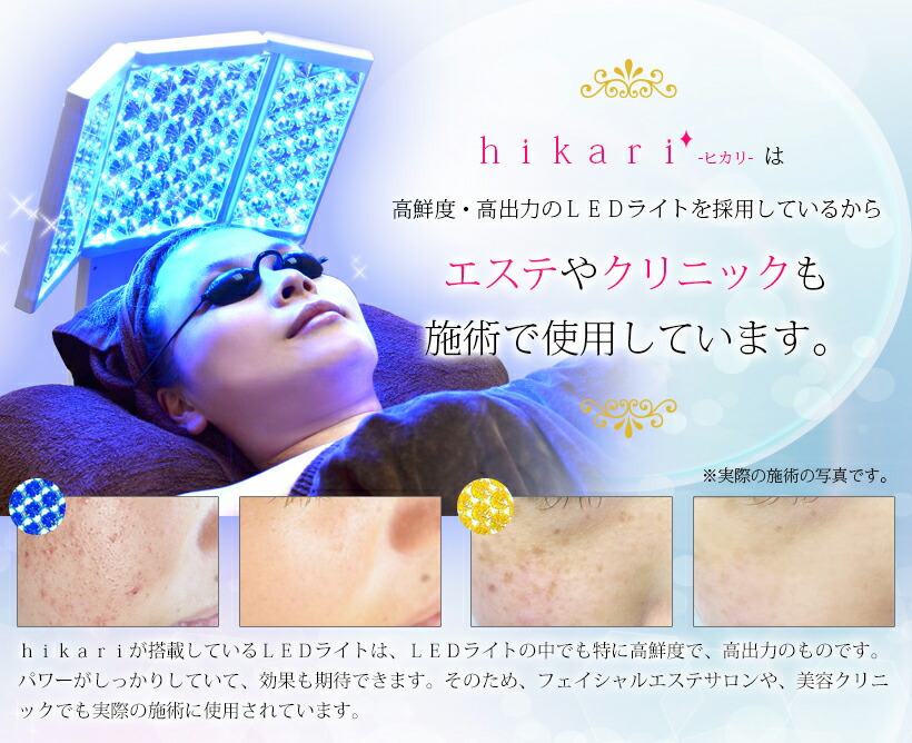 楽天市場】美ルル ヒカリフォトフェイシャル 美顔器 レゼント 光 美容