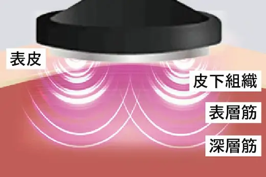 フォトプラス プレステージSP ⅢとSPの違いは？ヤーマンの美顔器の新旧