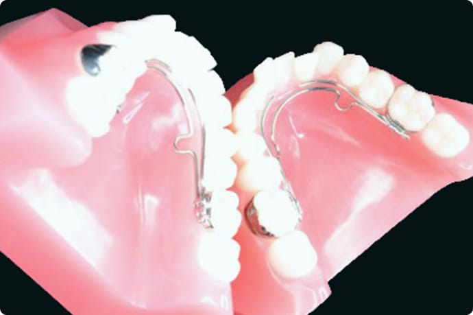 顎顔面矯正 洲本市 うえたに歯科｜淡路島南あわじ市・淡路市すぐ