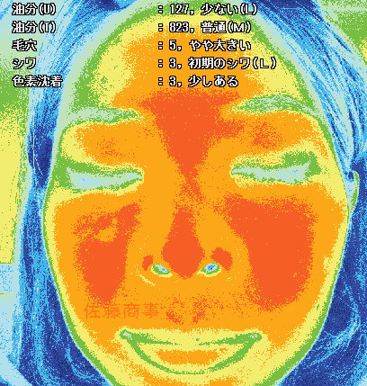 肌診断器A-ONE Lite（肌年齢測定つき）は販売終了しました | SATOTECH