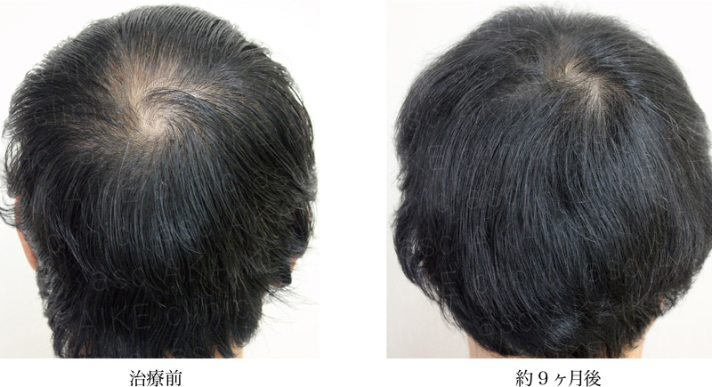 徳島 育毛 | men's asc 男性専用メディカルケア