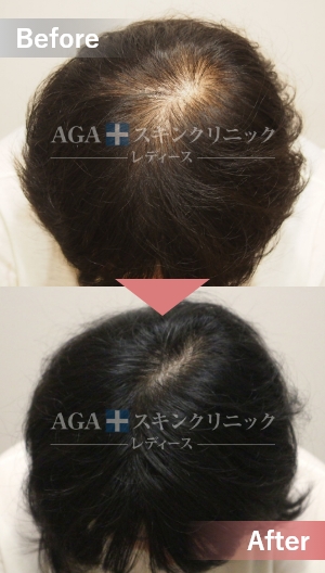 名駅錦通院（愛知県） - 女性の薄毛・抜け毛・FAGA治療はAGAスキン