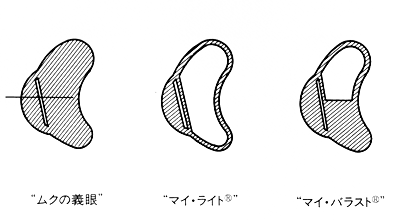 アツザワ義眼アイテム一覧｜お客様に合わせた義眼をオーダーメイドなど