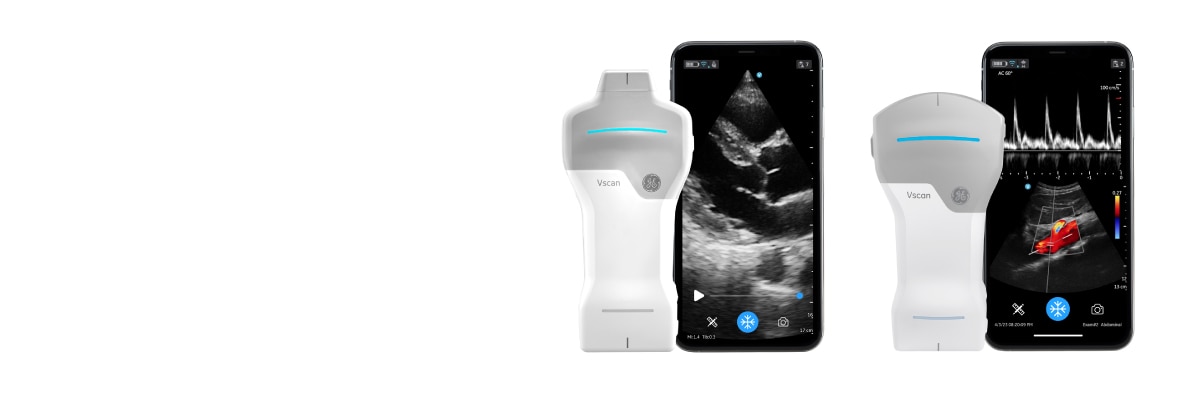 ポケットエコー Vscanシリーズ | 病院やクリニックの導入検討に | GE