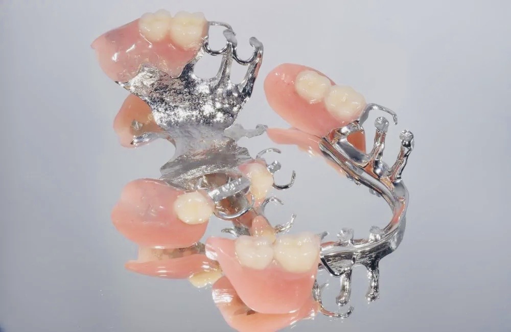 部分入れ歯（パーシャルデンチャー） | ふじの歯科医院