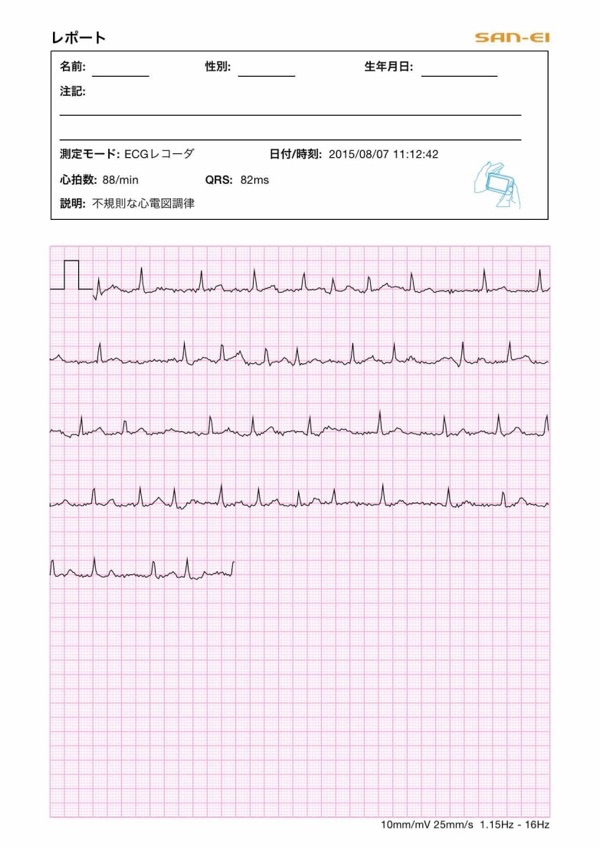 チェックミーの使用感｜港南台内科クリニック