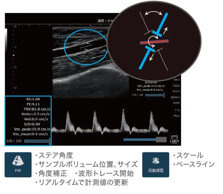 超音波診断装置 SONIMAGE HS2 | コニカミノルタ