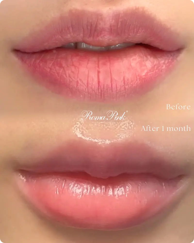 Roma Pink-ローマピンク- | フェイシャル【エステサロンKAREN（カレン）】