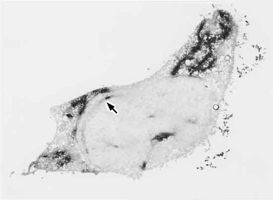 JAA106_I-017] 川上 他