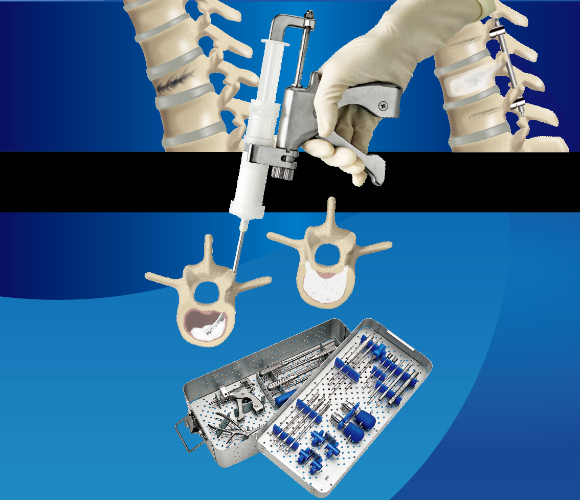 BIOPEX-R MVP | 医療関係者向け製品| 製品情報| HOYA Technosurgical