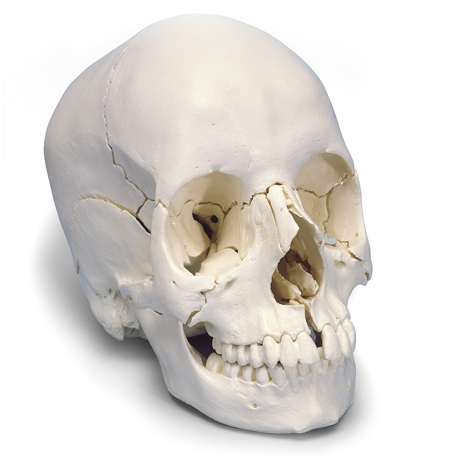 人体模型 頭蓋骨/22分解
