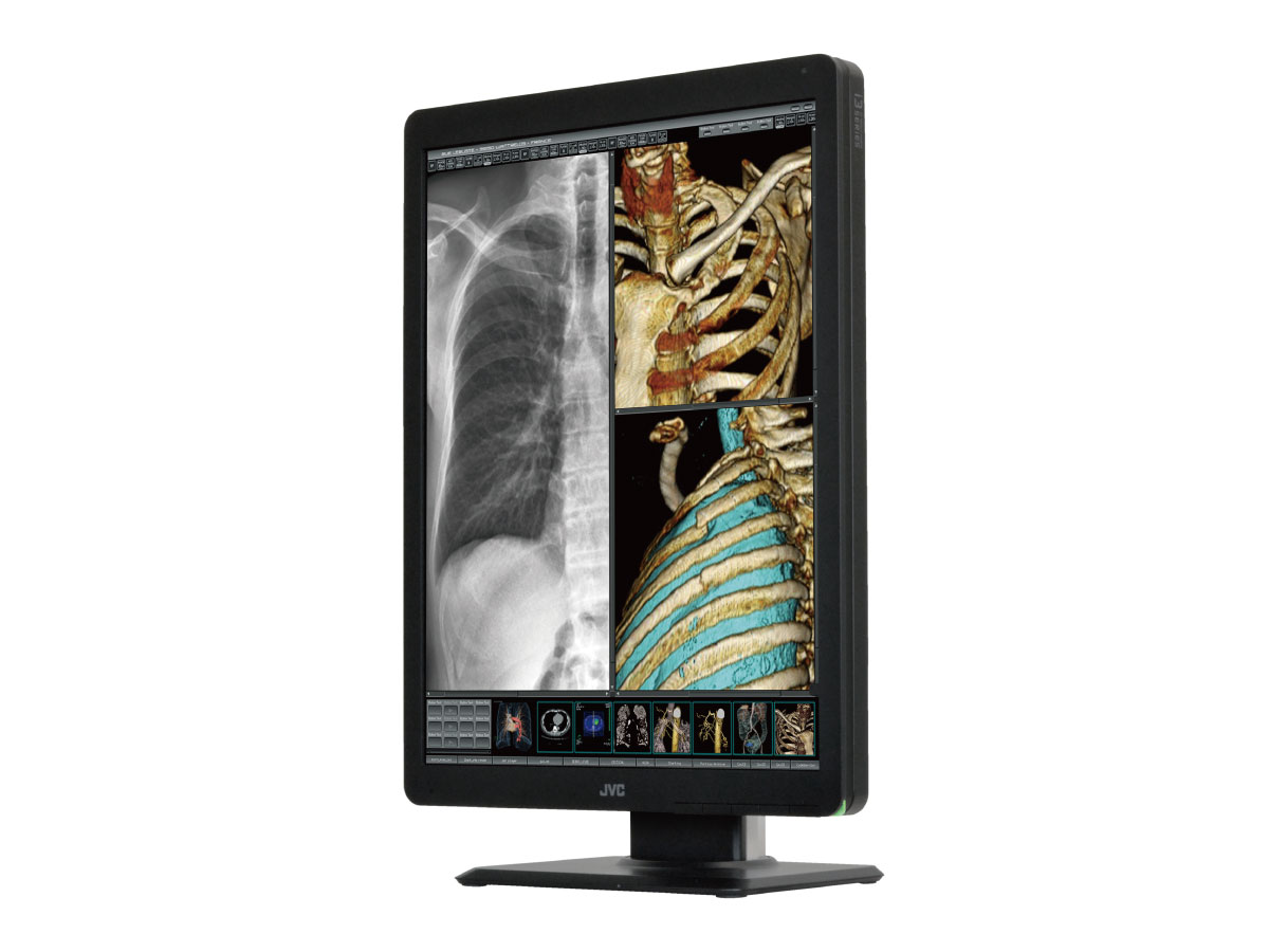 200万画素21.3型カラー液晶モニターCL-S200 | 医用モニター / 産業用