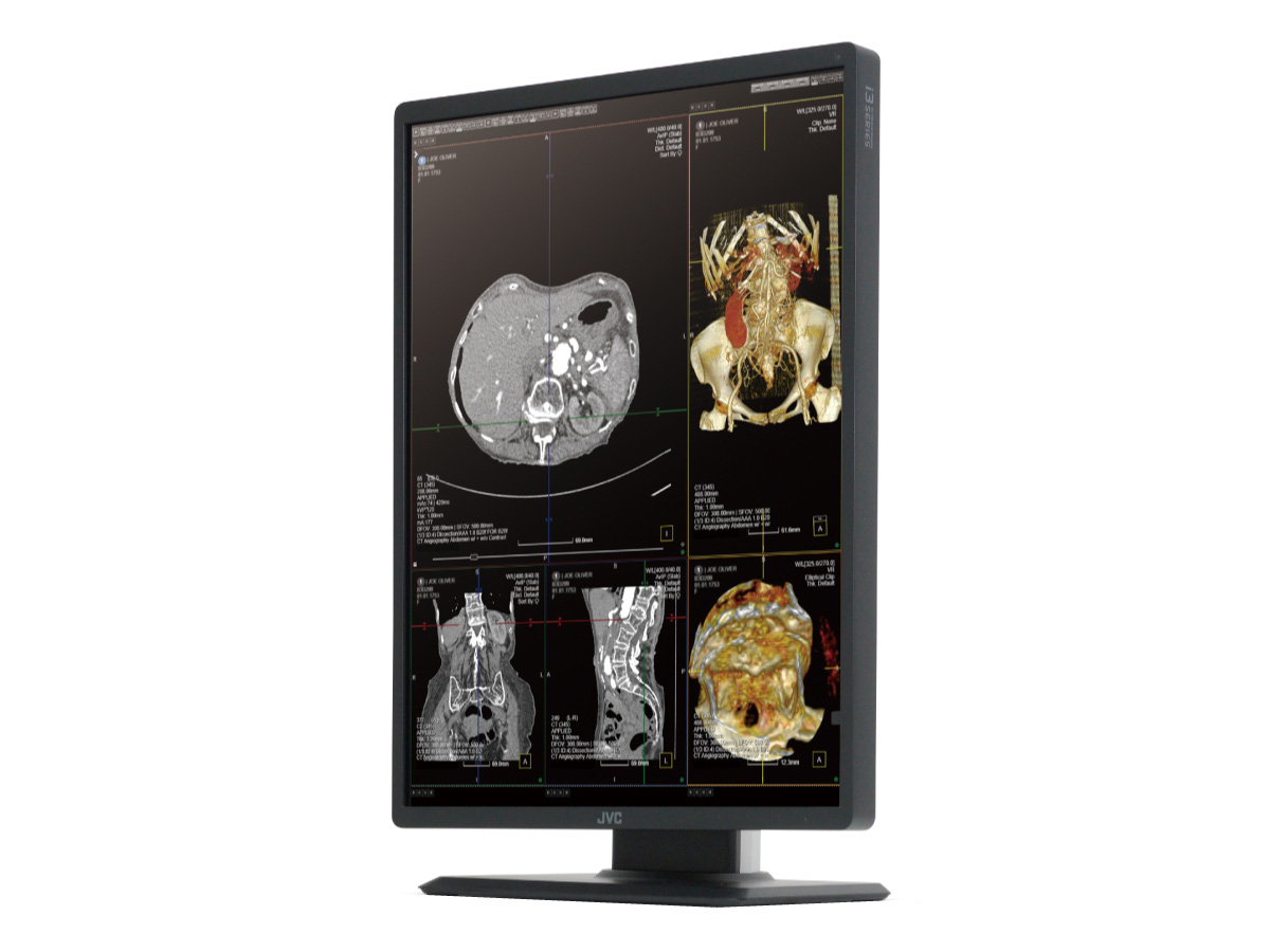 300万画素21.3型カラー液晶モニターCL-S301 | 医用モニター / 産業用