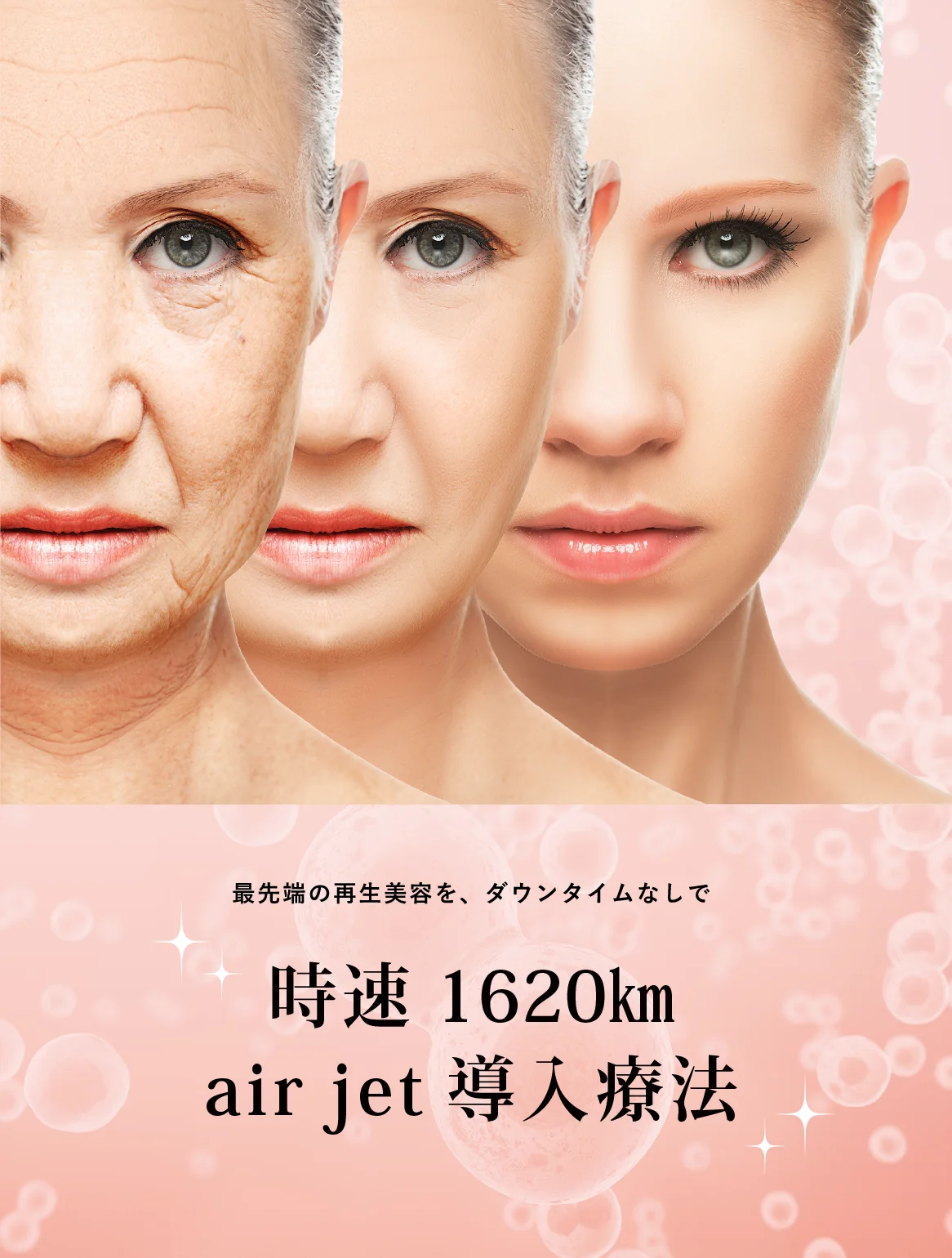 最先端の再生美容をダウンタイムなし【時速1620km air jet 導入療法