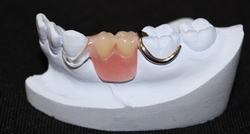 GLtest:入れ歯（義歯）について | まき歯科クリニック 立川市の歯医者