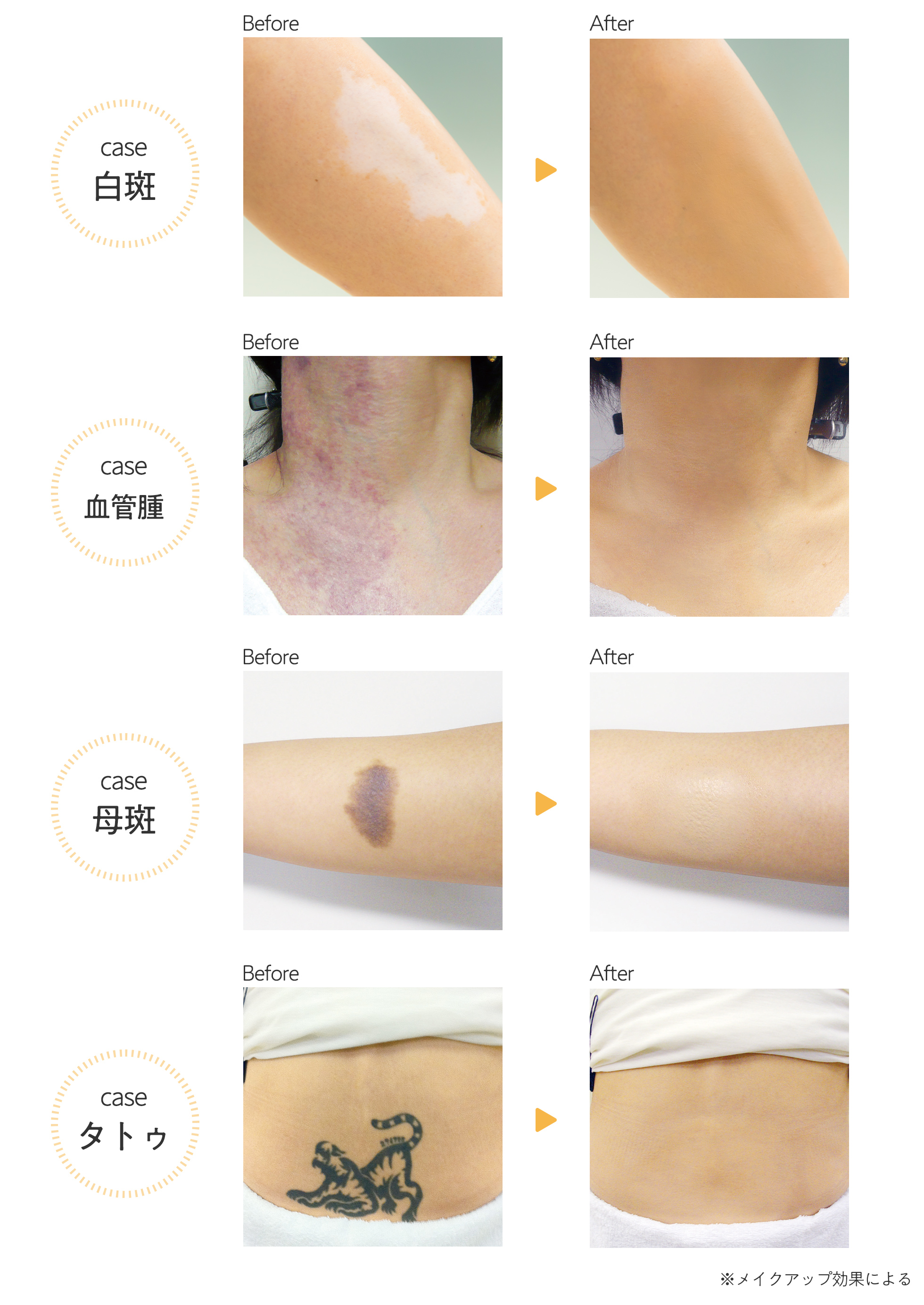 マーシュフィールド SC ボディカバーファンデN (各 40g)