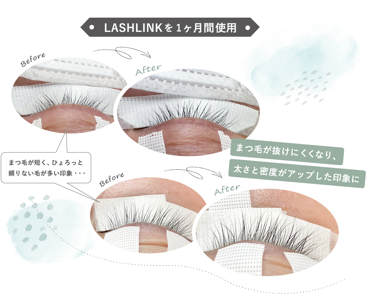 LASHLINK まつ毛美容液 2本セット まつ毛美容液 LASH LINK EYELASH