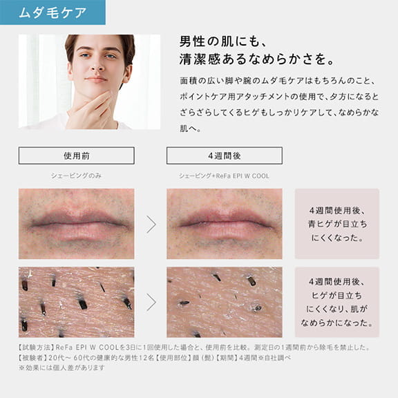 リファエピダブル クール（ムダ毛ケア最高峰モデル） | 光美容器