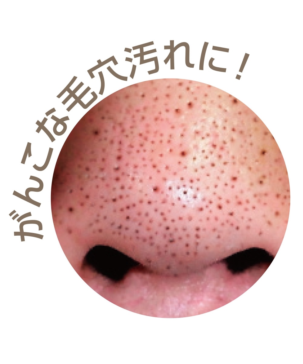 ミーゼ ダブルピーリング プレミアム＜美顔器＞ 通販【ニッセン】