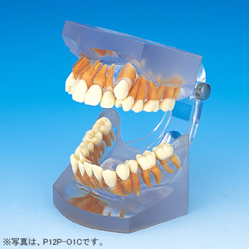 透明レジン製不正咬合模型 [P12P-O各種](P咬合器つき)｜株式会社