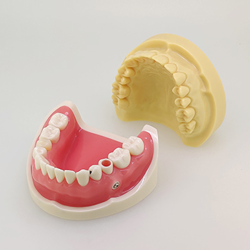 統合型実習用模型 [D16HD-X.1602]｜株式会社ニッシン｜歯科模型・歯科