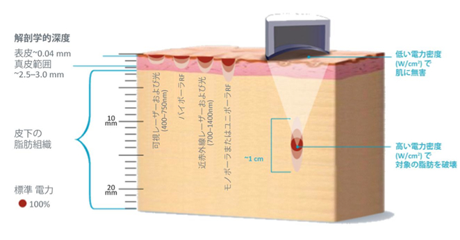 ライポソニックス（Liposonix）| ボディ・医療痩身｜北九州の美容外科
