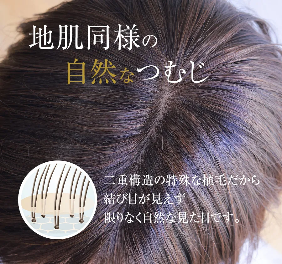 医療用ウィッグレミー｜レミープレミアム｜インフィニティロング