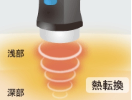 超音波機器「よう整骨院」