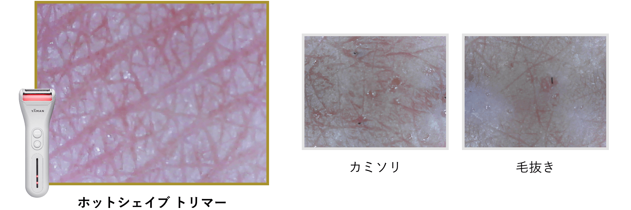 ホットシェイブ トリマー』温めて剃る。手軽に全身グルーミング