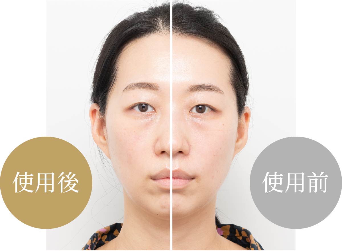 ハイパーフェイスリフトブラシ」進化したリフトケア。上向く実感