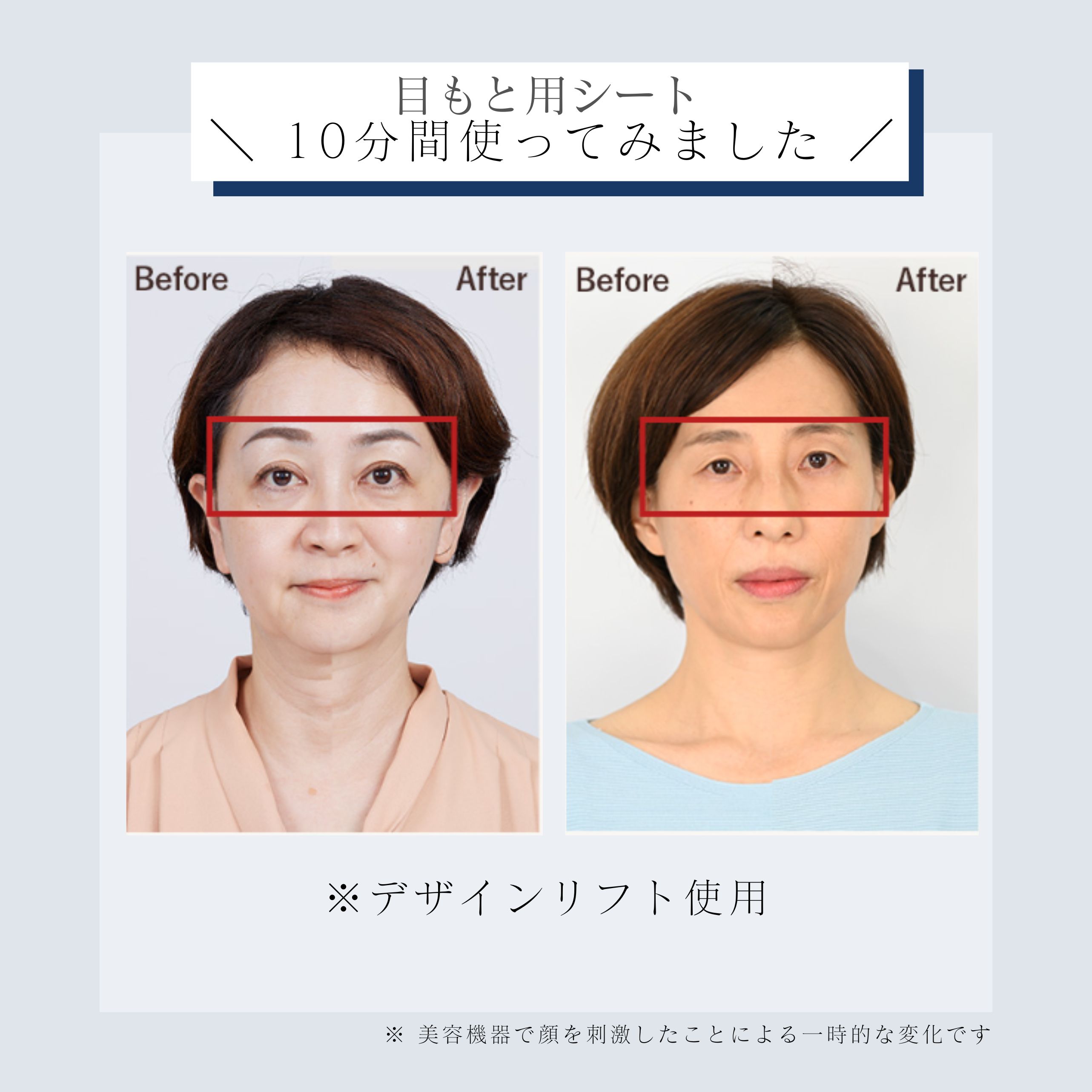 デザインリフトモア目もと＆口もとWケア4か月コースN（C1）｜ヤーマン