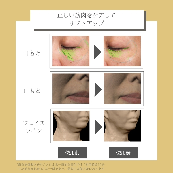 デザインリフトモア フルラインセット｜ヤーマン公式通販サイト