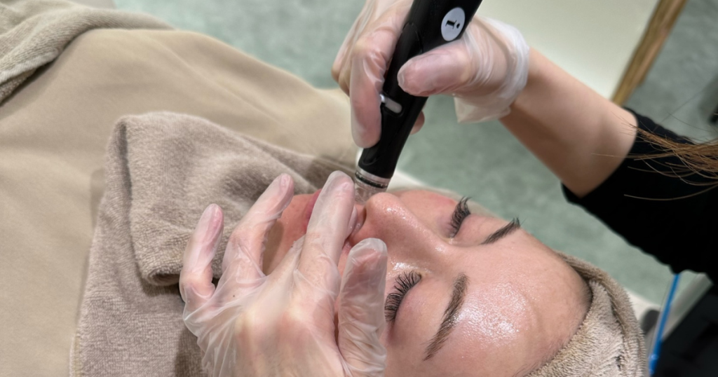 ハイドラフェイシャル｜毛穴の黒ずみ・毛穴洗浄｜広島 ヤヨイ