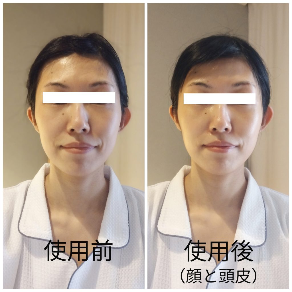 ストレスフリーにサロン級のお手入れができるリアボーテの美顔器